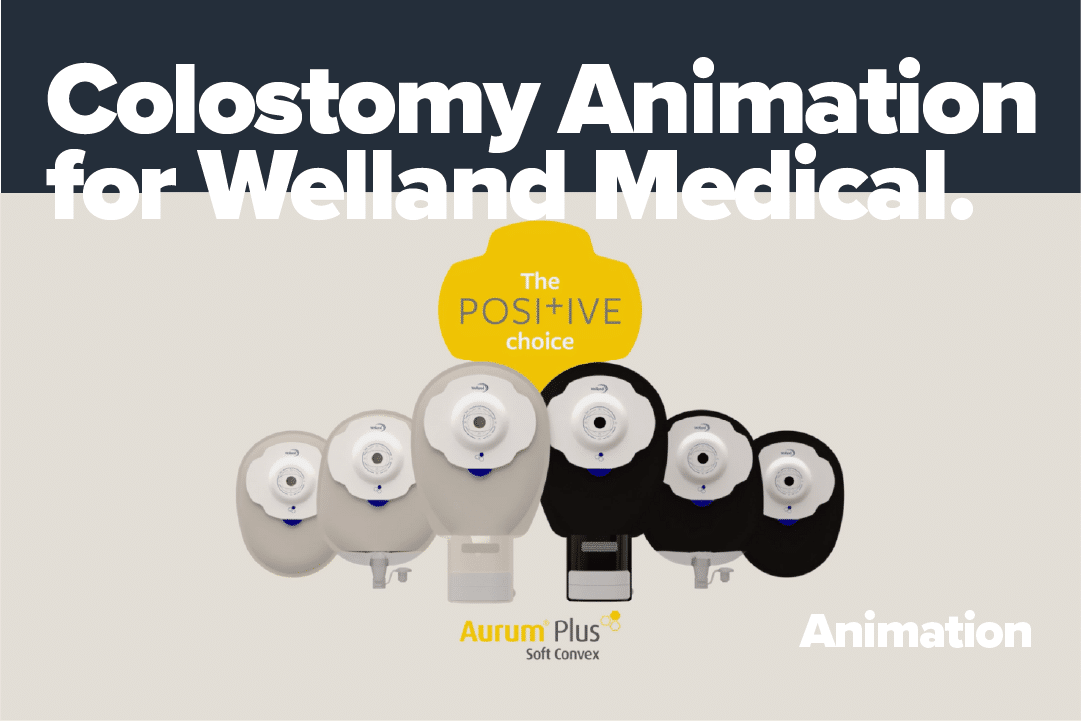 Colostomy Animation for Welland Medical!
